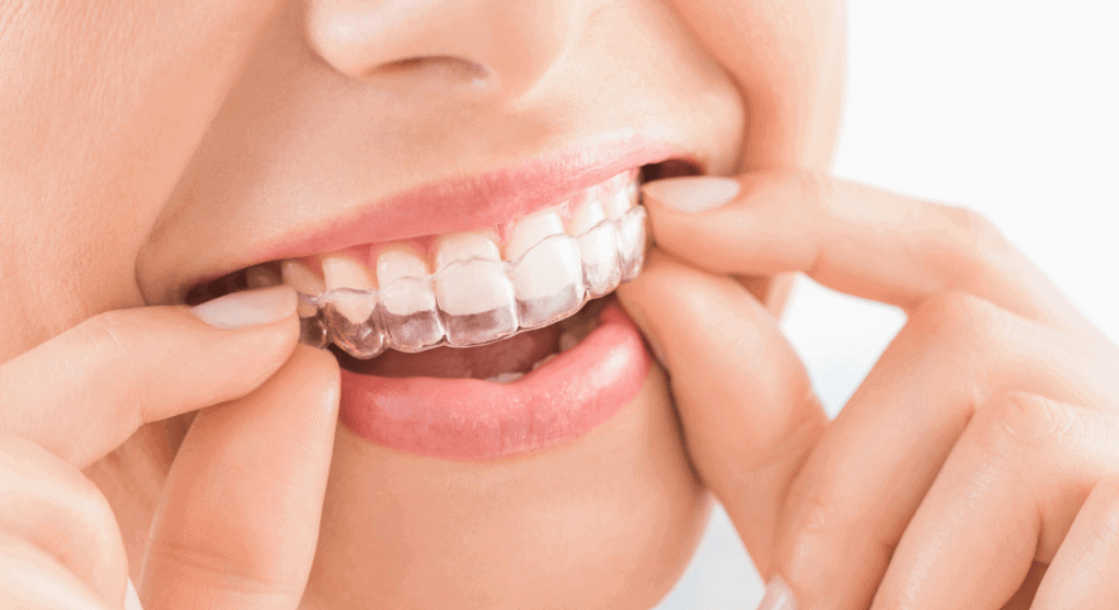 invisalign dental care