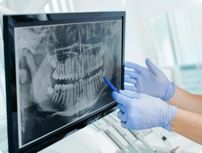 Dental-X-ray-in-Dubai