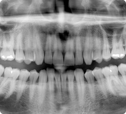 Dental-X-ray-in-Dubai