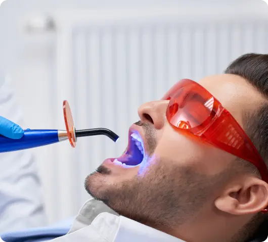 teeth-whitening-in-dubai