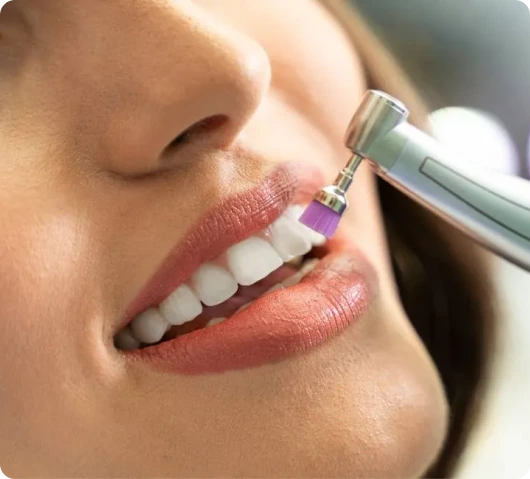 Teeth-Cleaning-in-Dubai