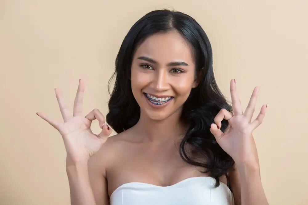 Braces-Cost-in-Dubai